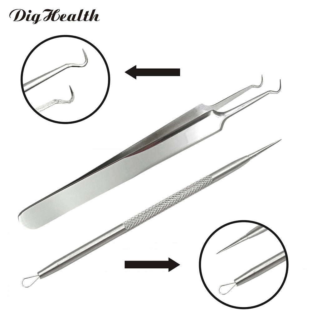 Professional Stainless Steel Blackhead Remover