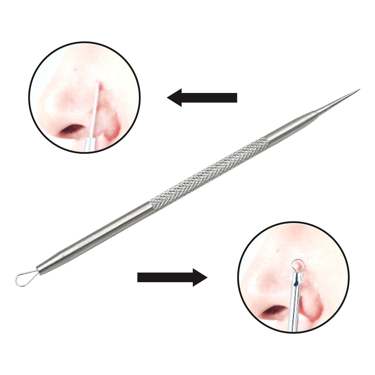 Professional Stainless Steel Blackhead Remover