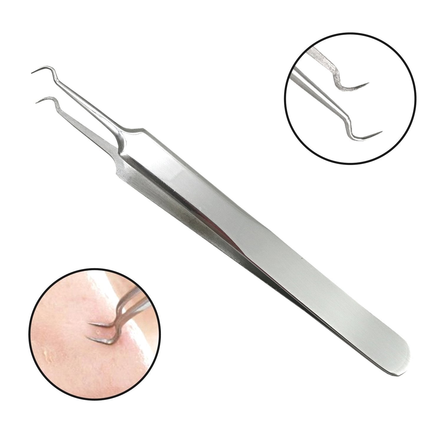 Professional Stainless Steel Blackhead Remover